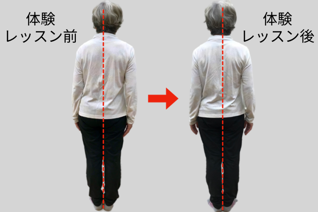 姿勢改善　ビフォーアフター　どこでもフィットジム
